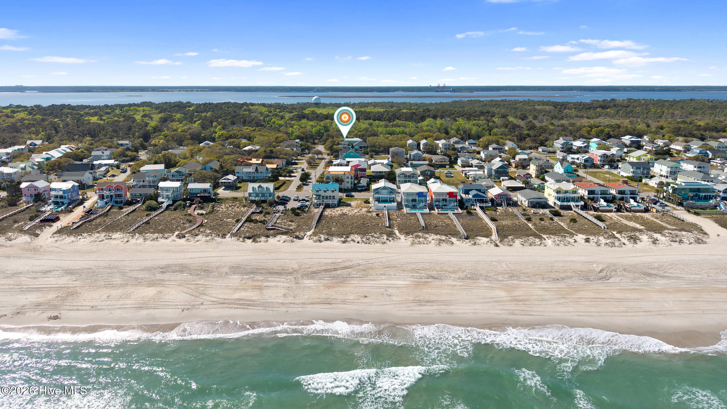 100535794 | Photo 90